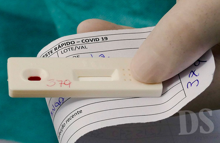 ALERTA – Casos de Covid-19 voltam a subir em Tangará da Serra