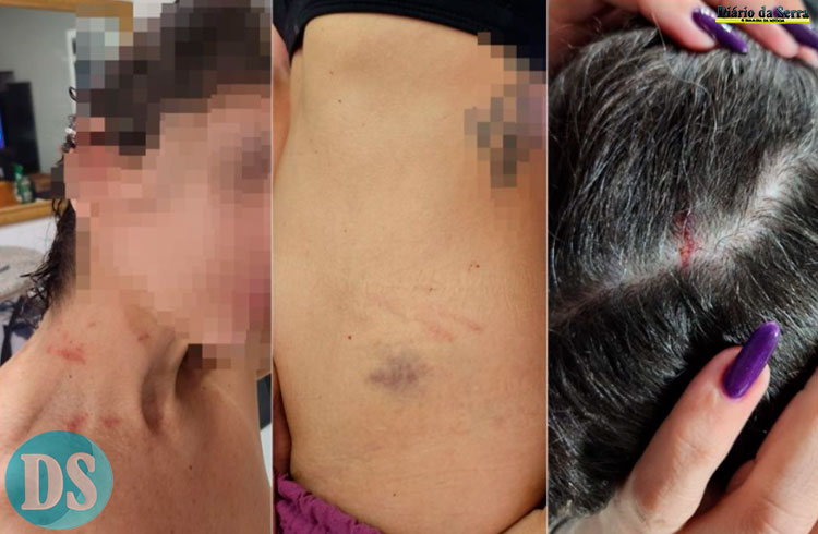 PANCADAS DE CASSETETE – “Vivendo filme de terror”, diz servidora que denunciou agressão